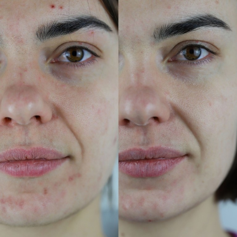 PAX face oil with CDB: before/after