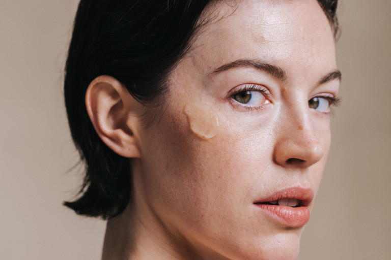 How to Reduce Hyperpigmentation Spots